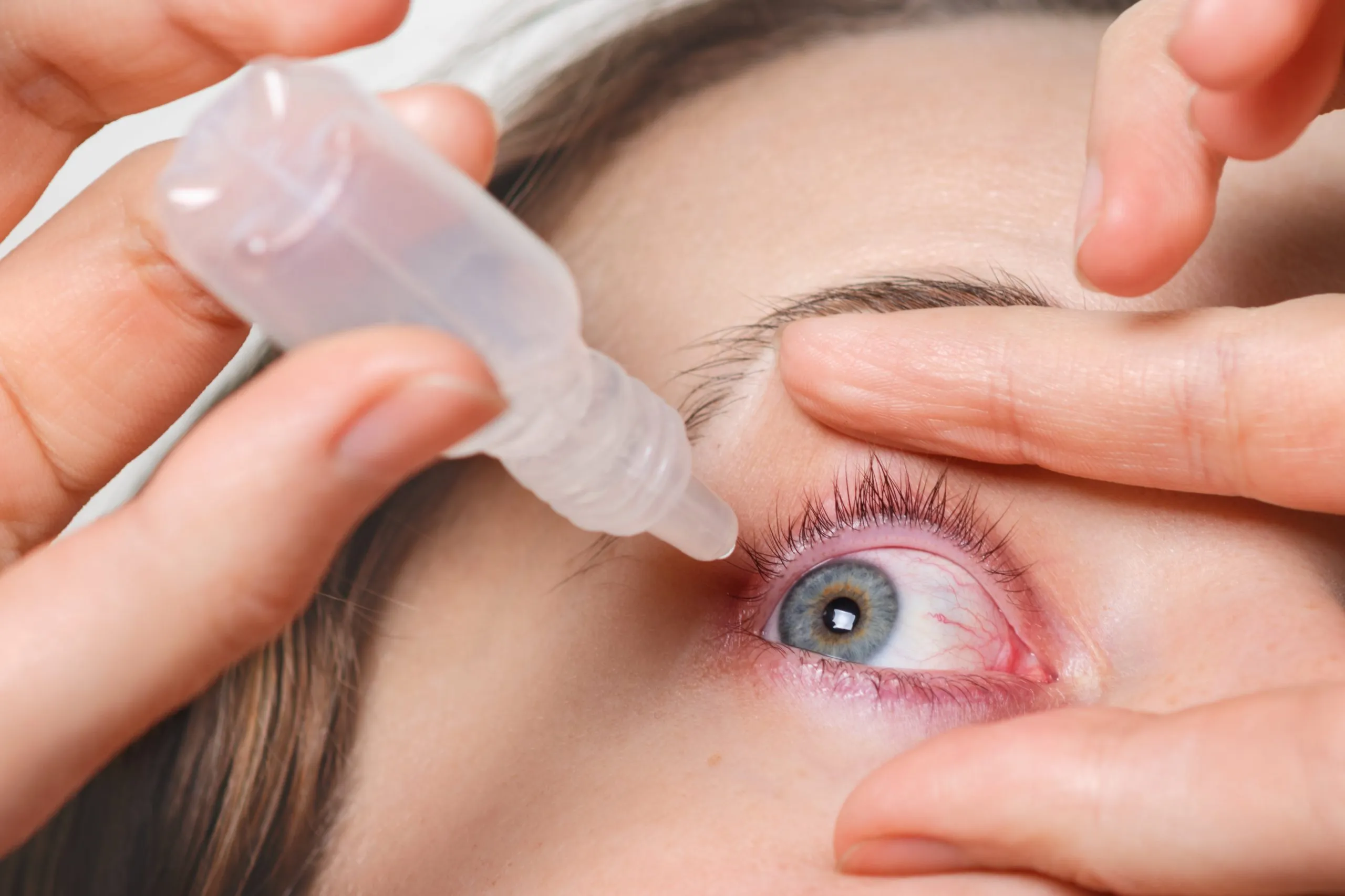 Redness of the eyes - Low Vision Aids Blog