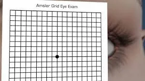 How to detect Macular Degeneration​