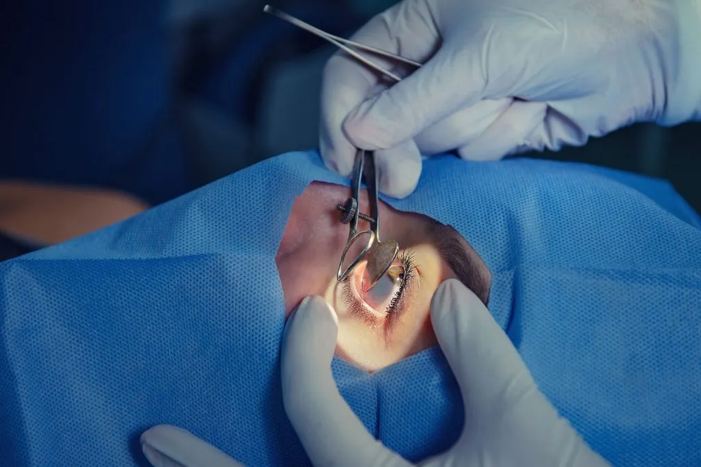 Treatment of Cataract