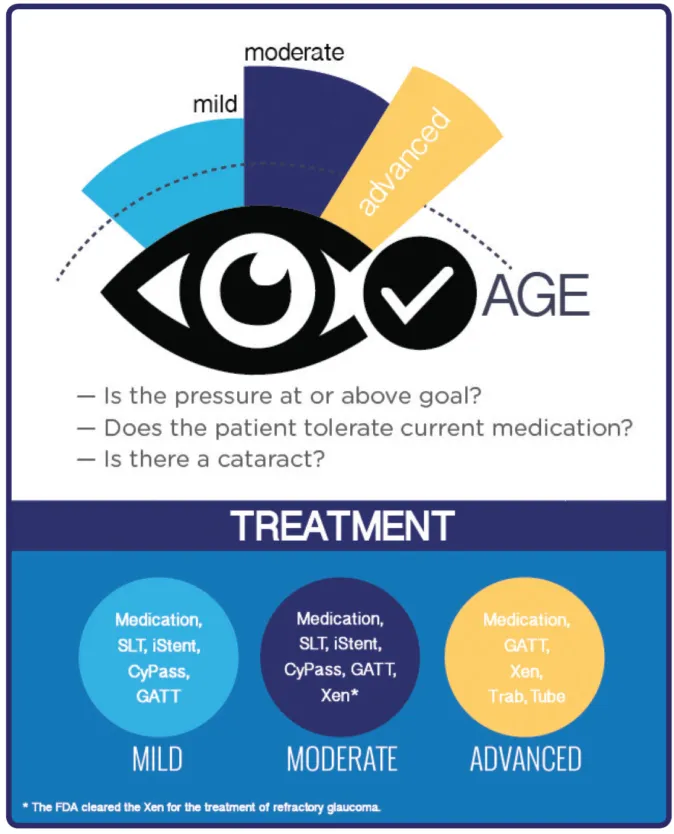treatments are available for Glaucoma