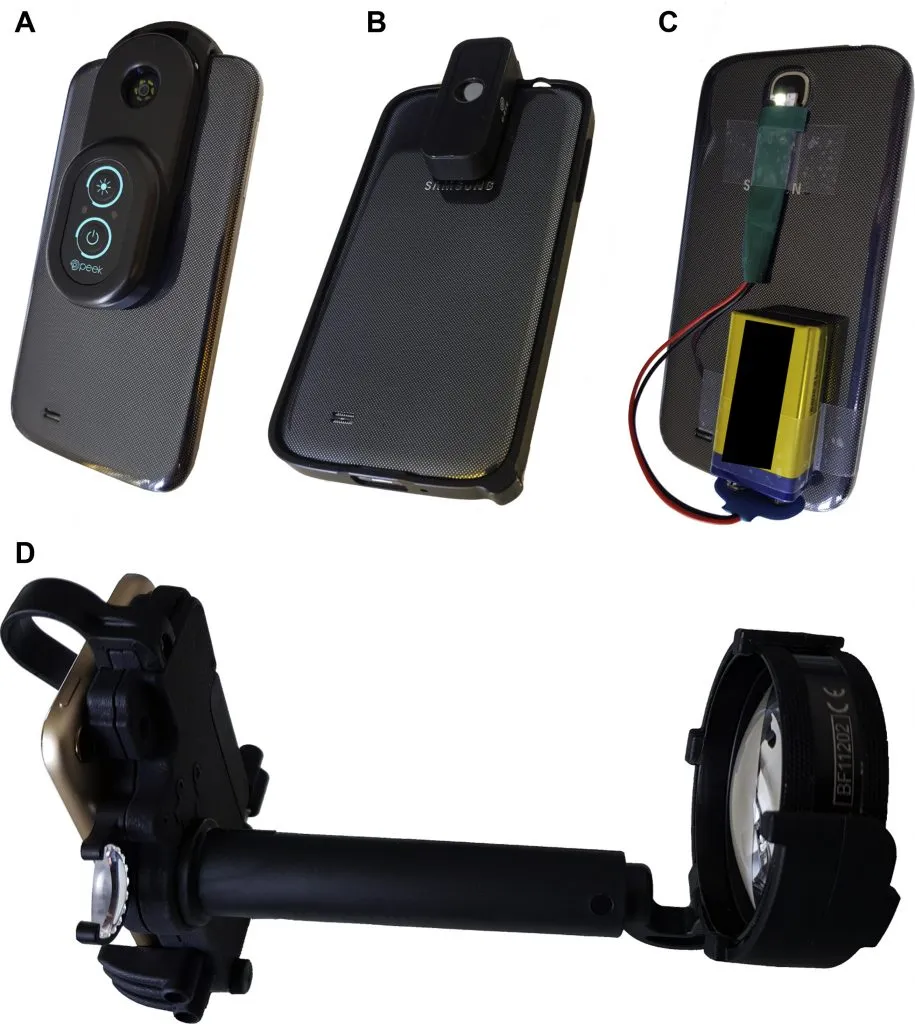 devices are available for Retinopathy