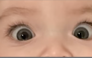 How Common is Strabismus