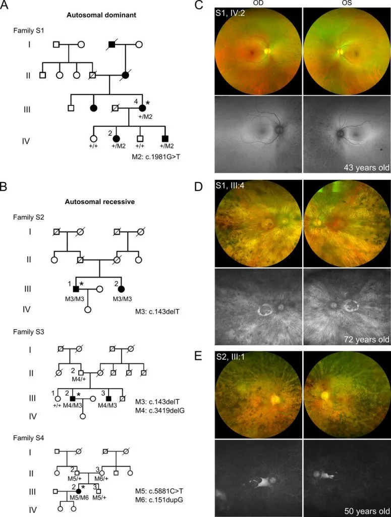 causes Retinitis Pigmentosa