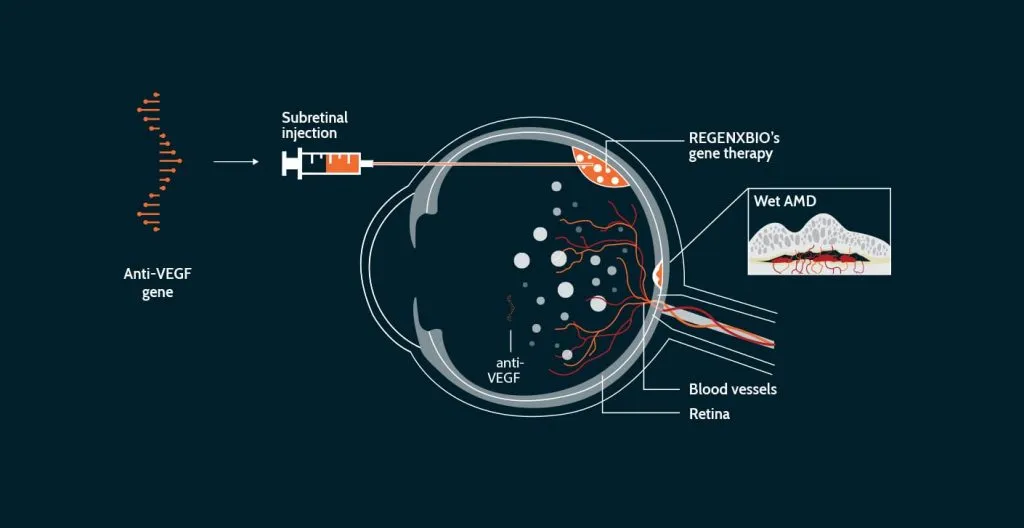 Gene Therapy for AMD