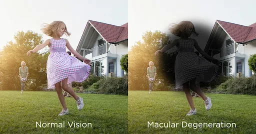 macula vision